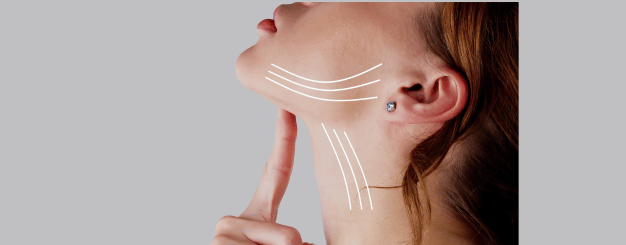 lipoaspiracao-de-papada